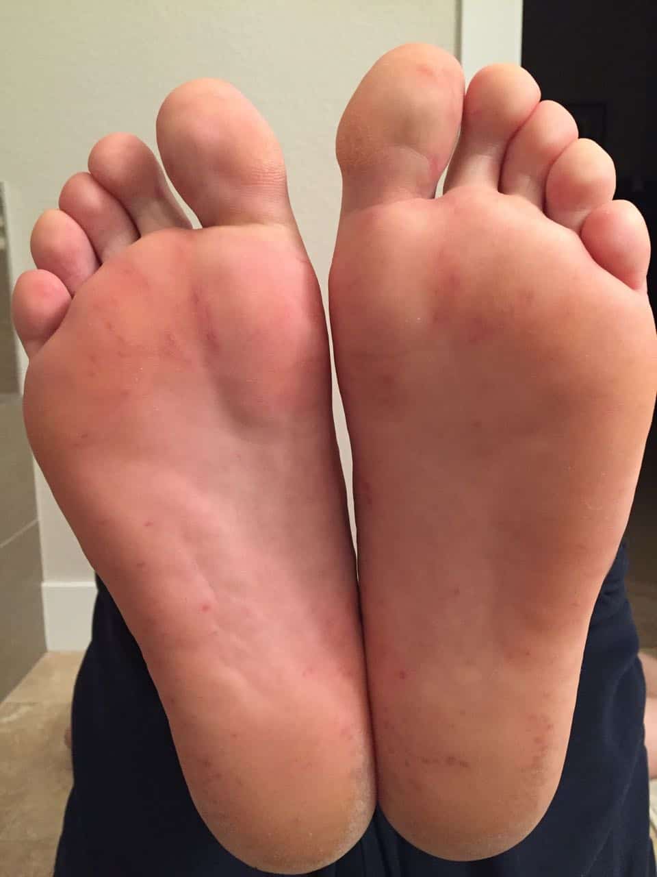 Feet Tuesday